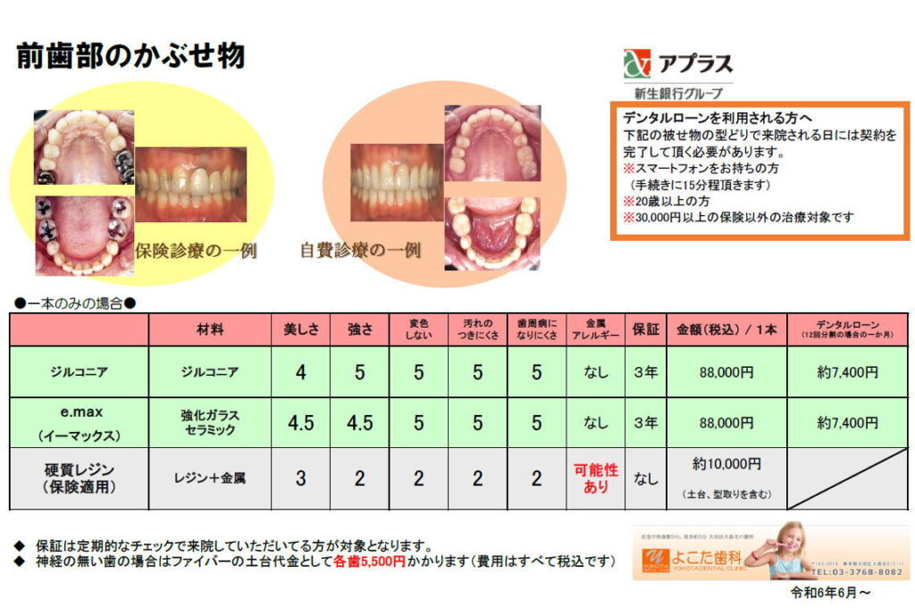 前歯部の価格表